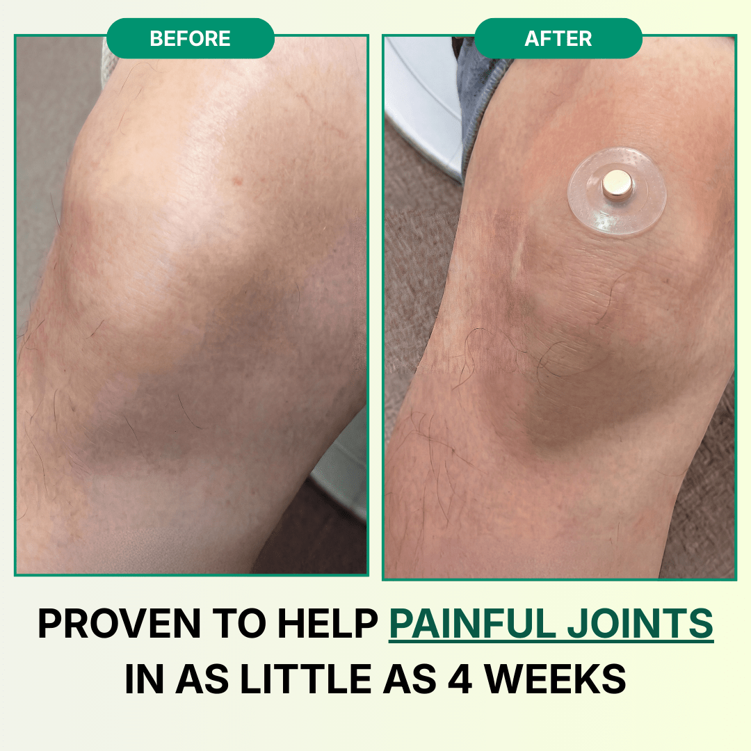 Magnetic Acupressure Patches - Regenvera